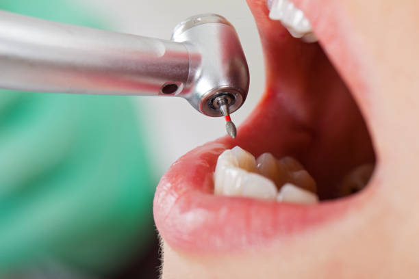 Best Emergency Broken Tooth Repair in Clute, TX